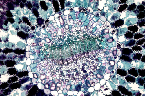 How Cellular Mechanisms Play a Role in Neurodegenerative Diseases – Part 6.