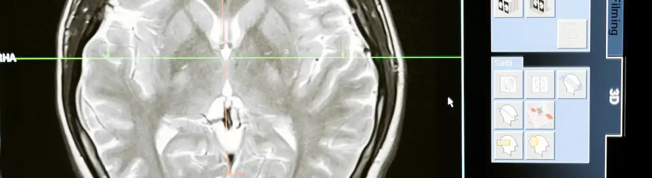 AI Everywhere: From Your Phone to Your Fridge (and Beyond!) 11 AI Everywhere