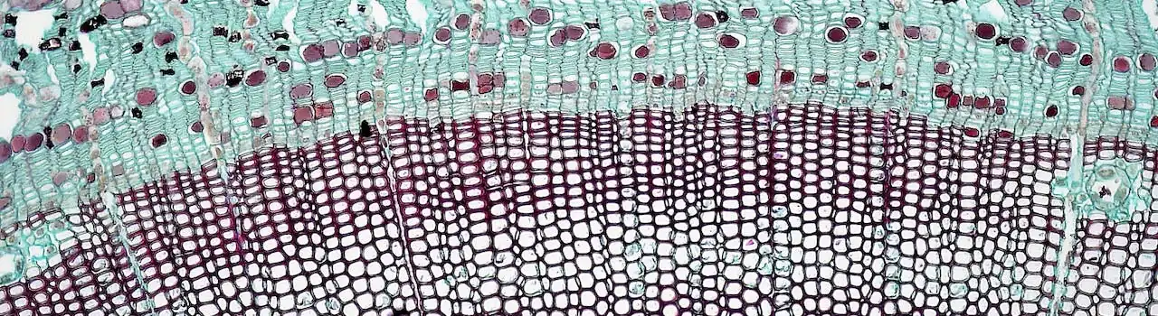 How Cellular Mechanisms Play a Role in Neurodegenerative Diseases - Part 6. 2 Cellular Mechanisms