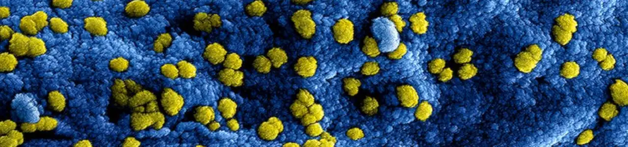 How Cellular Mechanisms Play a Role in Neurodegenerative Diseases - Part 6. 1 Cellular Mechanisms